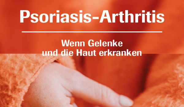 Psoriasis Arthritis im Überblick