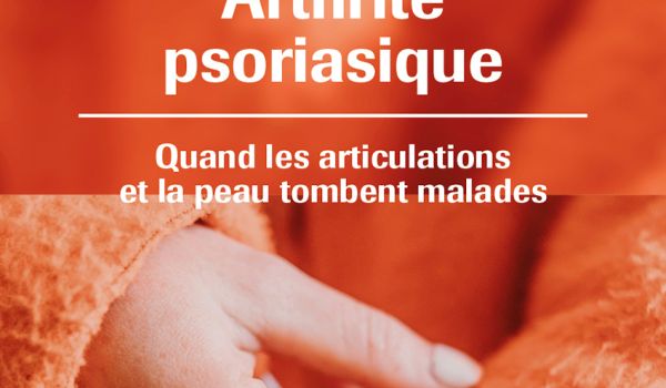 Aperçu de l'arthrite psoriasique